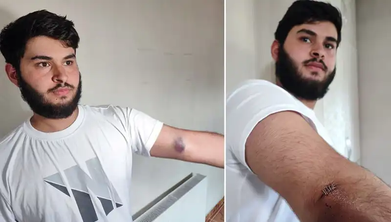 Bahçeye Kaçan Topun Ardından Gelen Kamyonet Dehşeti Yarattı
